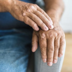 Revitalize with ayurveda: psoriatic arthritis treatment