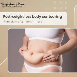 Loose skin removal surgery - dr sudhanva