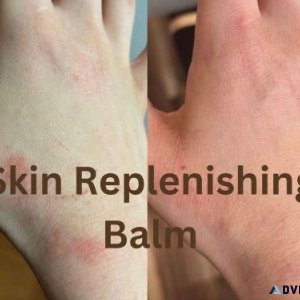Skin s Best Friend Miel Healing s Must-Have Balm