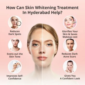 Skin whitening treatment in hyderabad
