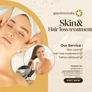 Prp for hair loss clinic in anna nagar