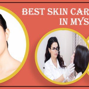 Best skin care hospital in mysore