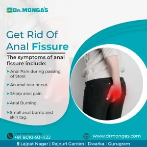 Anal fissure treatment in rohini - 8010931122