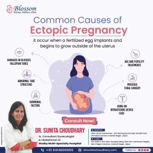 Best gynecologist doctor in vaishali nagar jaipur