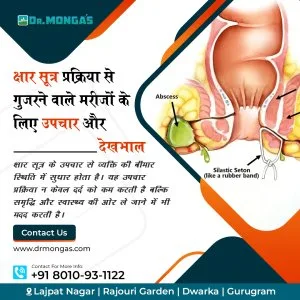 Best kshar sutra doctors in rohini 8010931122