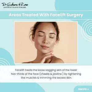 Face lift surgeon - drsudhanva