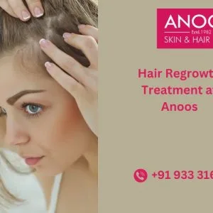 Advanced hair regrowth treatment at anoos