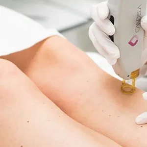 Grace and glamour: best hair removal in gurgaon