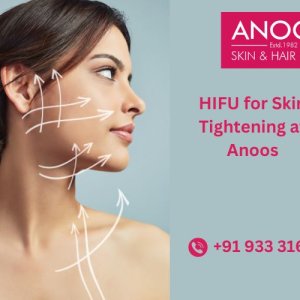 Advanced hifu treatment for skin tightening at anoos