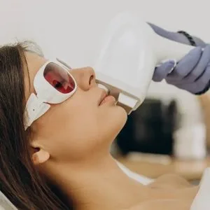 Photofacial treatment in ludhiana