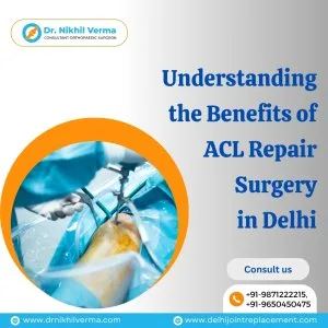 Acl repair surgeon in delhi | dr nikhil verma