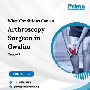 Arthroscopy surgeon in delhi | prime specialty