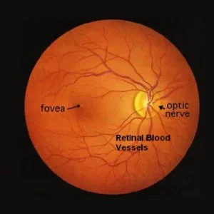 Retinal detachment surgery