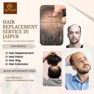 Permanent hair replacement service in jaipur