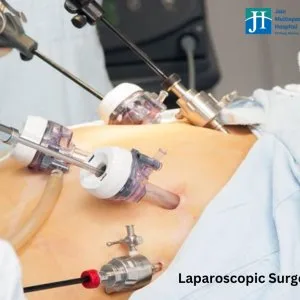 Laparoscopic surgery in army card