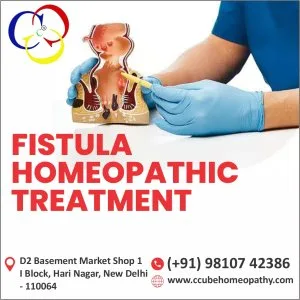 Treating fistulas with homeopathy: benefits and best practices