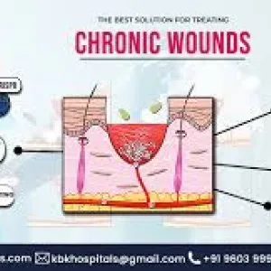 Chronic non-healing wounds