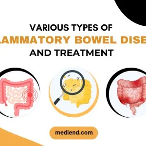 Various types of inflammatory bowel disease and treatment