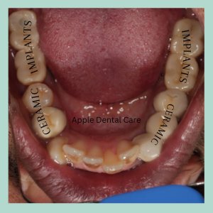 Best dental clinic in coimbatore