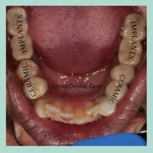 Best dental clinic in coimbatore