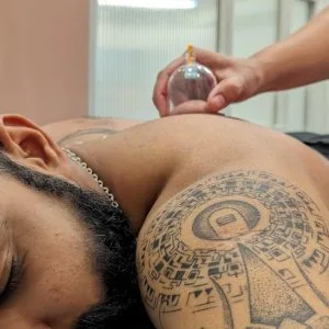 Cupping therapy