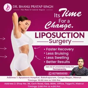 Best liposuction surgery in ncr