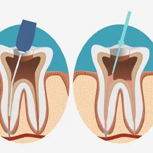 Best dentist in zirakpur : gupta smile clinic