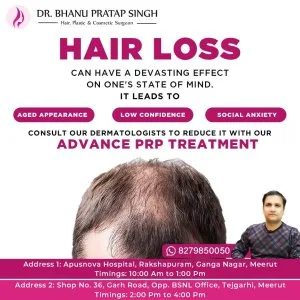 PRP Therapy Doctor in NCR
