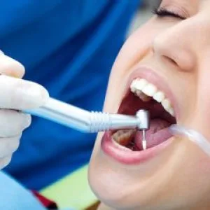 Teeth whitening in al ain