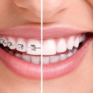 Cheapest dental clinic in abu dhabi