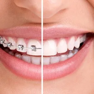 Cheapest dental clinic in abu dhabi