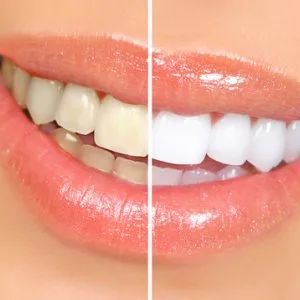 How to find the best dentist in jamnagar for your dental care