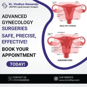 Top-rated gynecologist in hyderabad - dr vindhya gemaraju