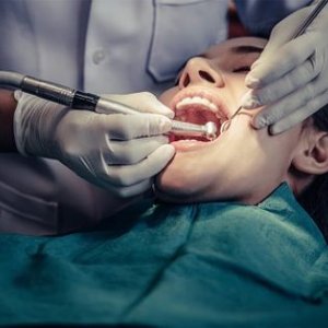 Cheap tooth filling in abudhabi