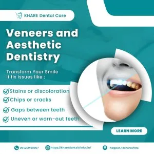 Best dental care in nagpur – khare dental clinic | dentist near