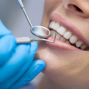 Dental clinic near kukatpally