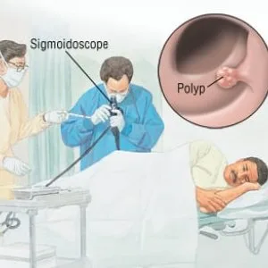 Sigmoidoscopy test centre in delhi ncr |easy book my lab