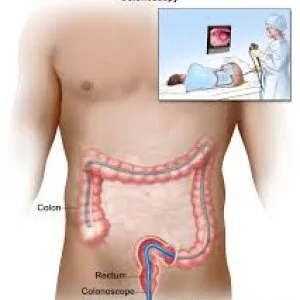 Colonoscopy test center in delhi | easy book my lab