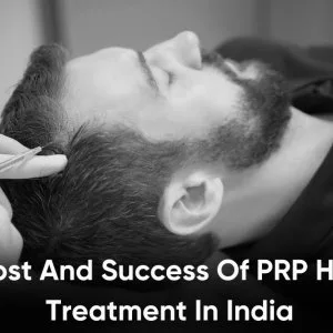 Prp treatment cost in india