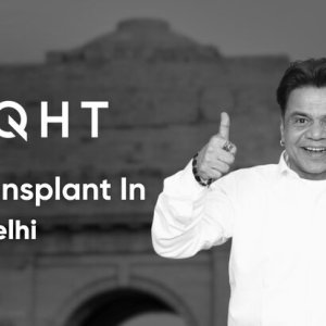 Affordable hair transplant cost in delhi – get natural results
