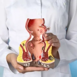 Kshar sutra treatment in lucknow for piles & fistula