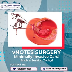 Best vnotes surgery doctor in hyderabad – dr vindhya gemaraju