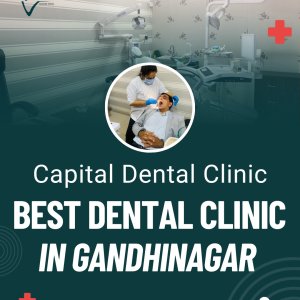 Best dental clinic in gandhinagar – capital dental clinic