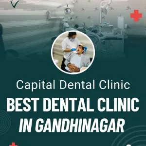 Best dental clinic in gandhinagar – capital dental clinic
