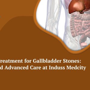 Ercp treatment for gallbladder stones | induss medicity