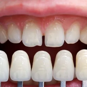 Best dental clinic in jivraj park