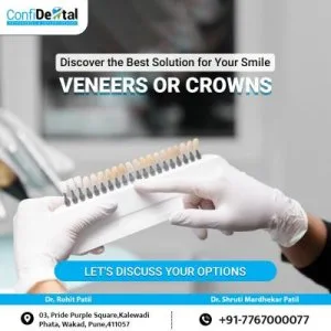  confidental dental clinic and implant center in wakad | implant