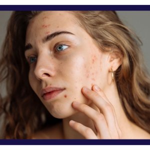 Dermiq clinic: best skin clinic in hyderabad