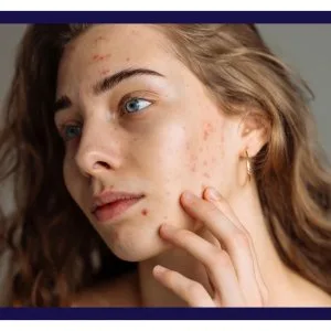 Dermiq clinic: best skin clinic in hyderabad