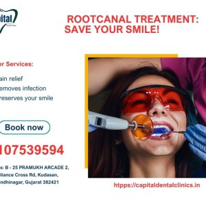  Gentle Pain-Free Root Canal Treatment at Capital Dental